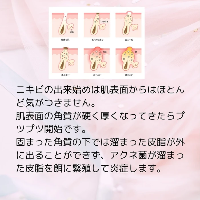 画像243